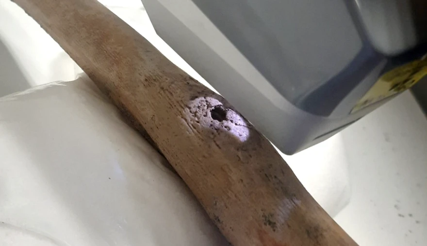 Tracing syphilis and mercury in skeletal remains from a late medieval Dutch infirmary