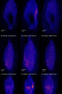Fig3 COL2 Adistribution v3