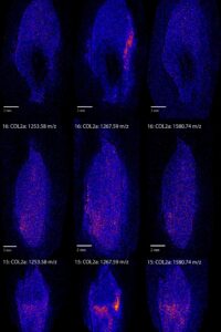 Fig3 COL2 Adistribution v3